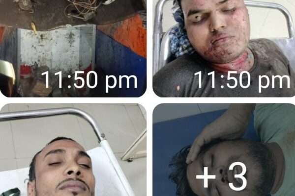 मुरादाबाद के एक निजी बैंक्विट हॉल में लिफ्ट गिरने से हादसा
